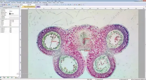 Видеоокуляр ToupCam 10 Мпикс (U3CMOS10000KPA) фотография