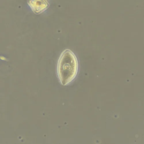 Фазово-контрастное устройство MAGUS SPH360 с набором объективов План ПолуАпохромат Plan S-Apo Ph 4х/10х/20х/40х/60х H60 мм изображение