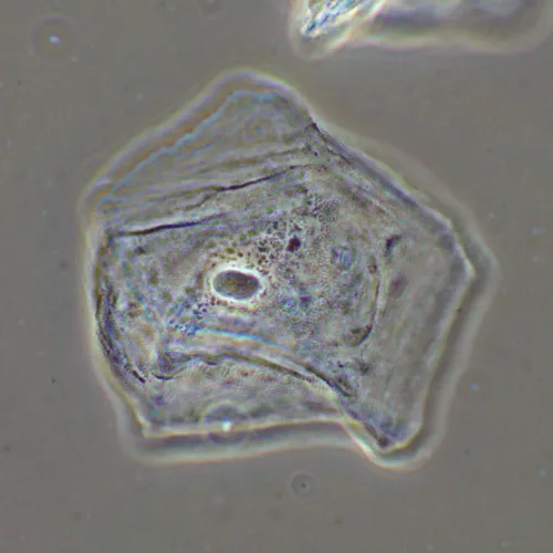 Фазово-контрастное устройство MAGUS SPH2 фото