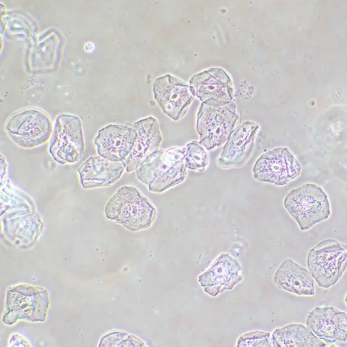 Фазово-контрастное устройство MAGUS SPH2 изображение